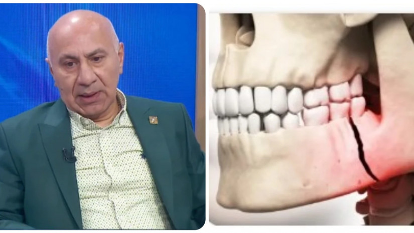 ექიმიექიმი