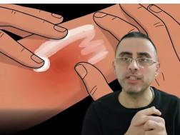 კოტე თოდუა