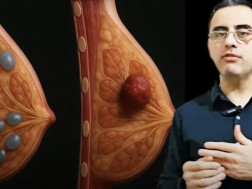 კოტე თოდუა