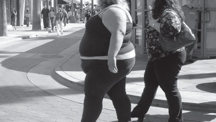 სიმსუქნე  სიმსუქნ  სიმსუქნე  სიმსუქნ