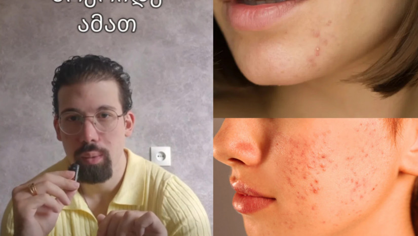 სანდრო ჯიბლაძე