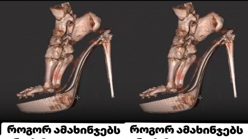 ტერფიტერფი ტერფიტერფი