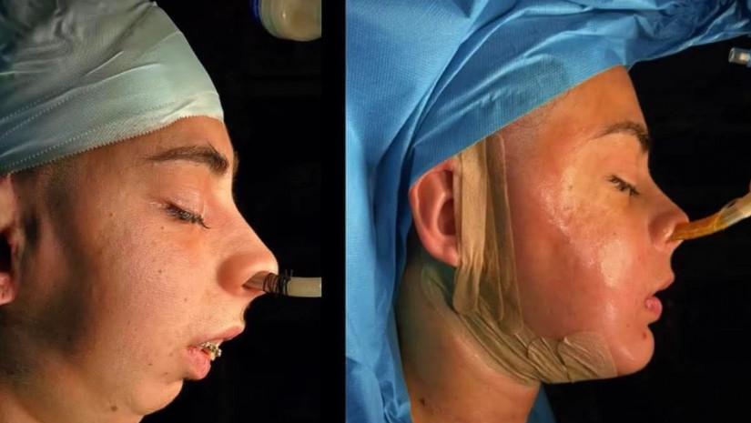 დანტესიდანტესი