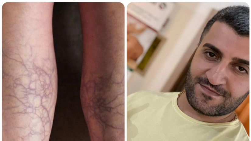  მამუკა რაშოიანი.