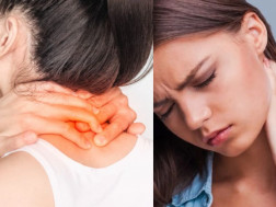 კისრის გაშეშება