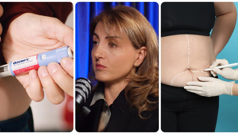 ოზემპიკი თუ ბარიატრია