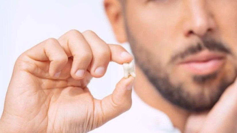 სიბრძნის კბილი