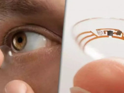 თვალის ლინზა