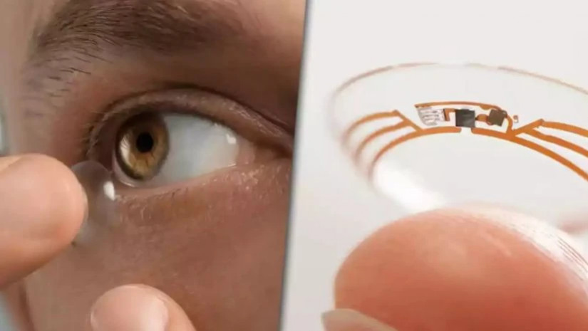 თვალის ლინზა