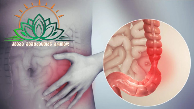 მუცლის შებერილობა