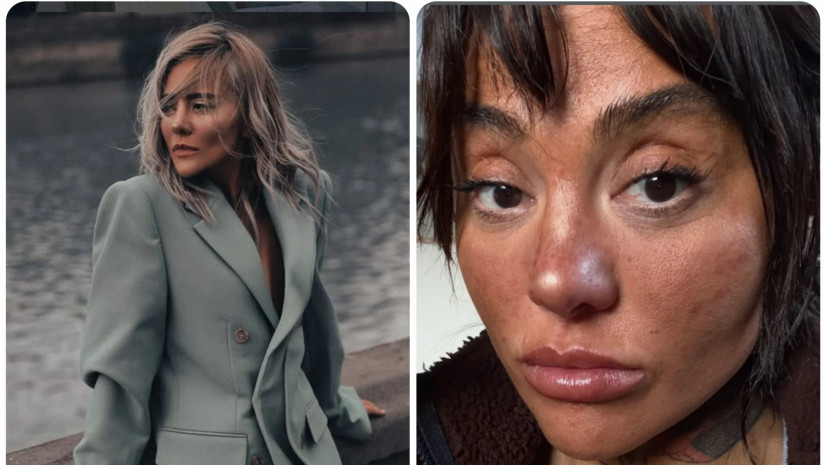 მარი ნაკანი