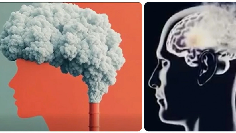 ალცაიმერი           