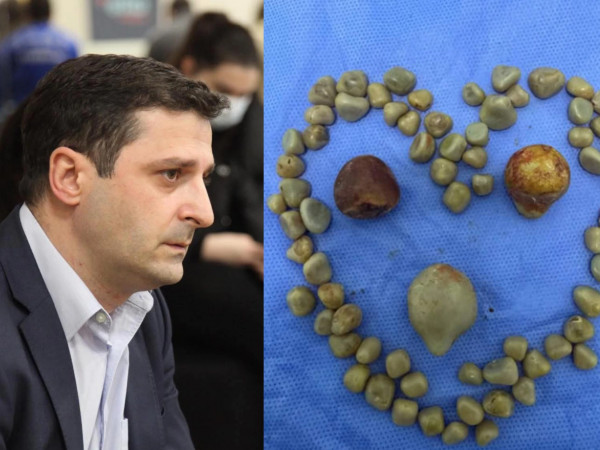 ოთარ კეპულაძე