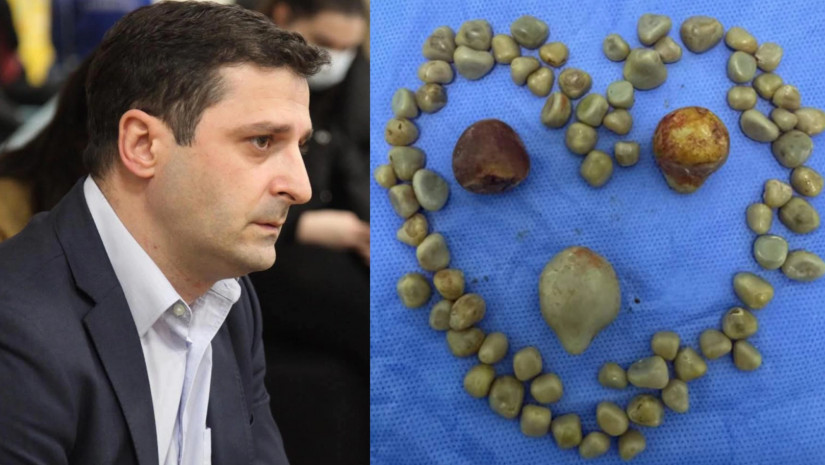 ოთარ კეპულაძე