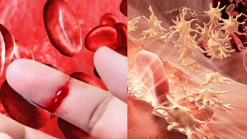 ჰემოფილია ჰემოფილია