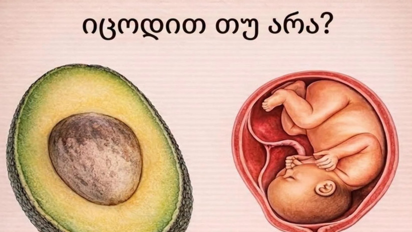 ავოკადოავოკადო