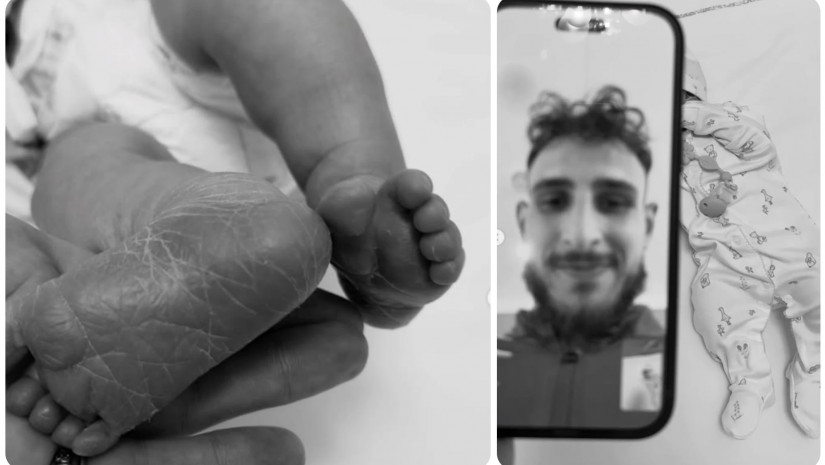 ანრი მექვაბიშვილი