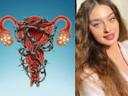 ვაგინიზმი ვაგინიზმი