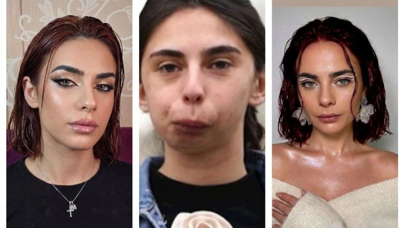 ლილიანა გოგოჭური