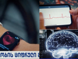 ჭკვიანი საათი